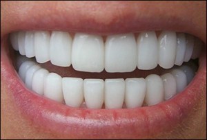 Состояние зубов очень важно для здоровья и имиджа человека 